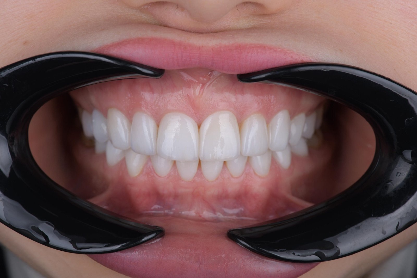 smile design first examination