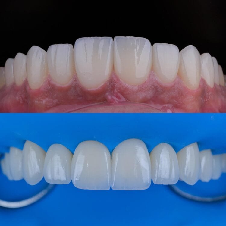 zahngesundheit blog ankara