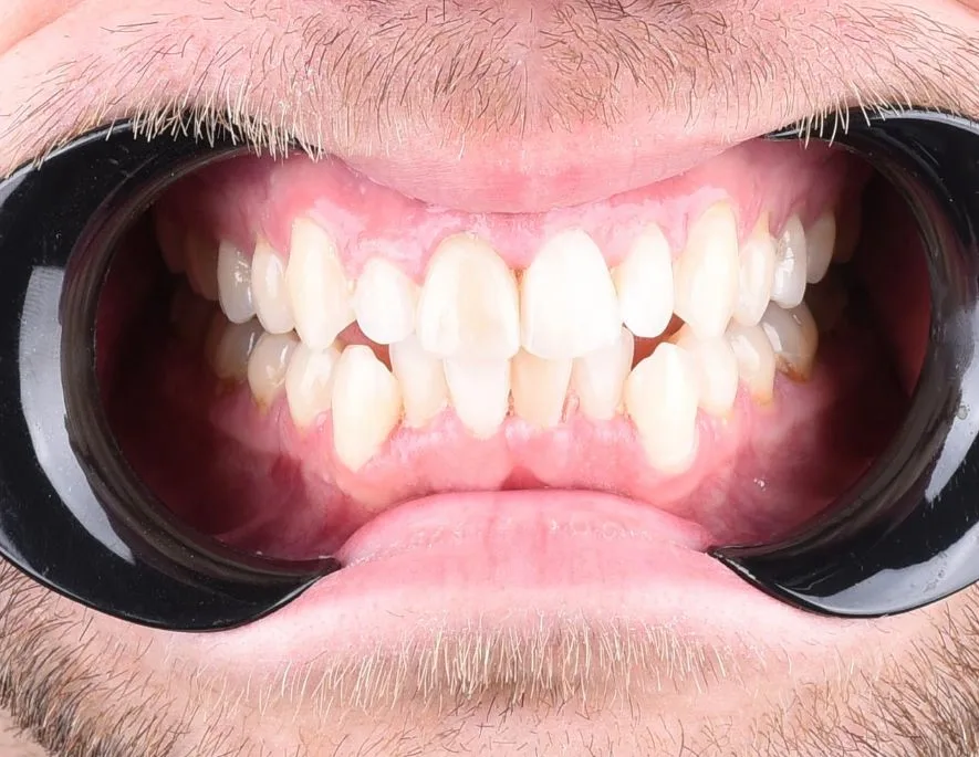 digital smile design